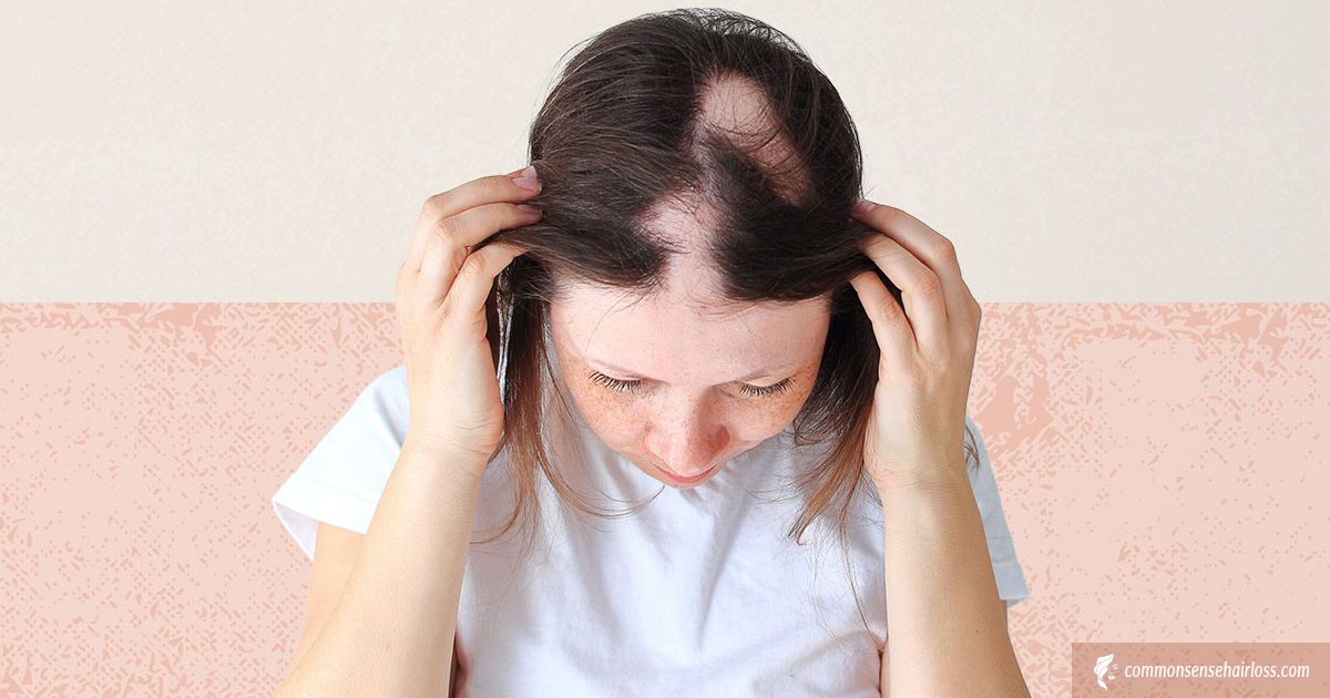 Causes of Abnormal Hair Loss in Children