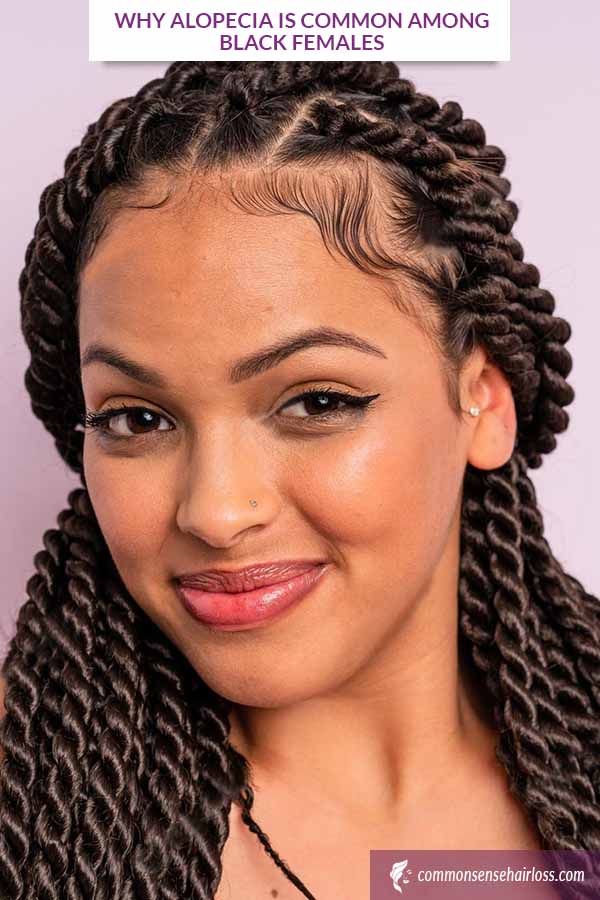 Why Alopecia Is Common Among Black Females